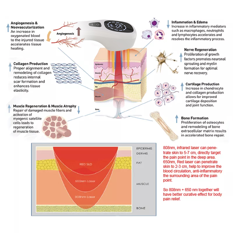 Dispositivo per terapia laser  - Pet Supplies Outlet recensione e prezzo